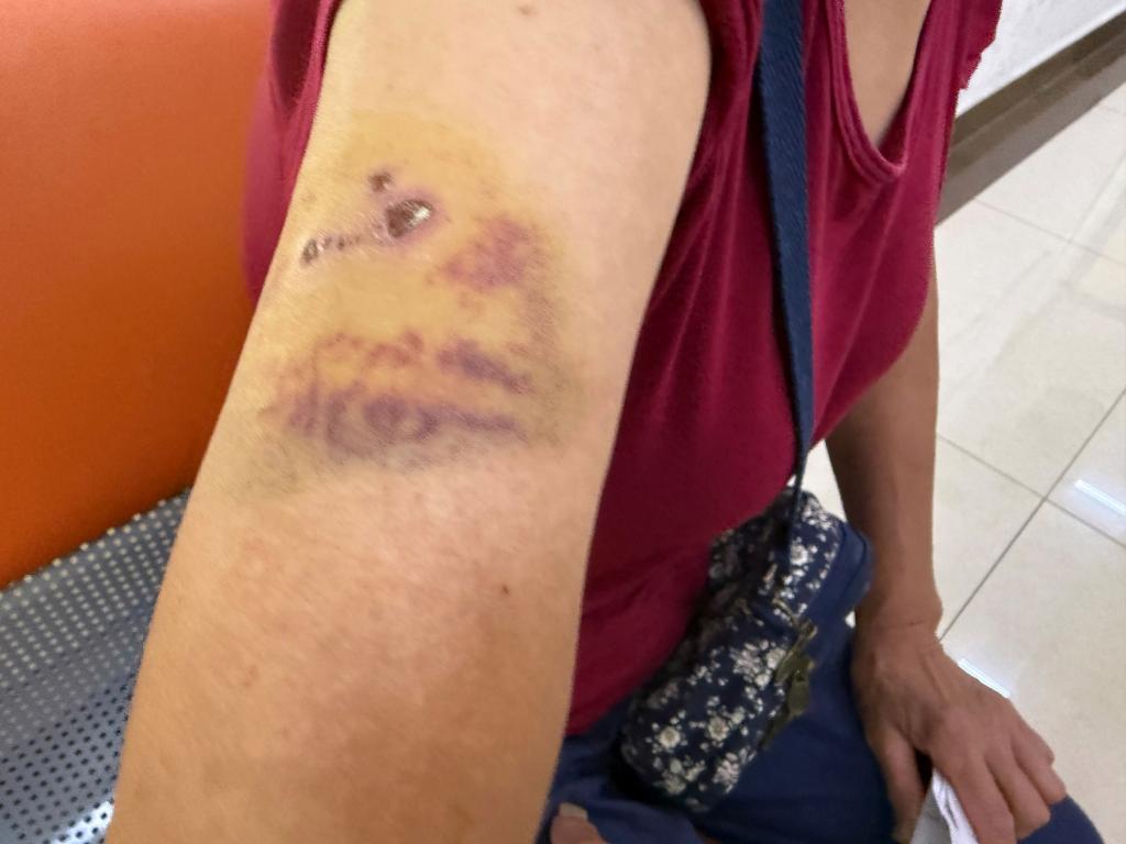 上海犬伤门诊迎接诊高峰:除了猫犬咬伤外,还有患者被蝙蝠咬伤 上海犬伤门诊迎接诊高峰:除了猫犬咬伤外,还有患者被蝙蝠咬伤